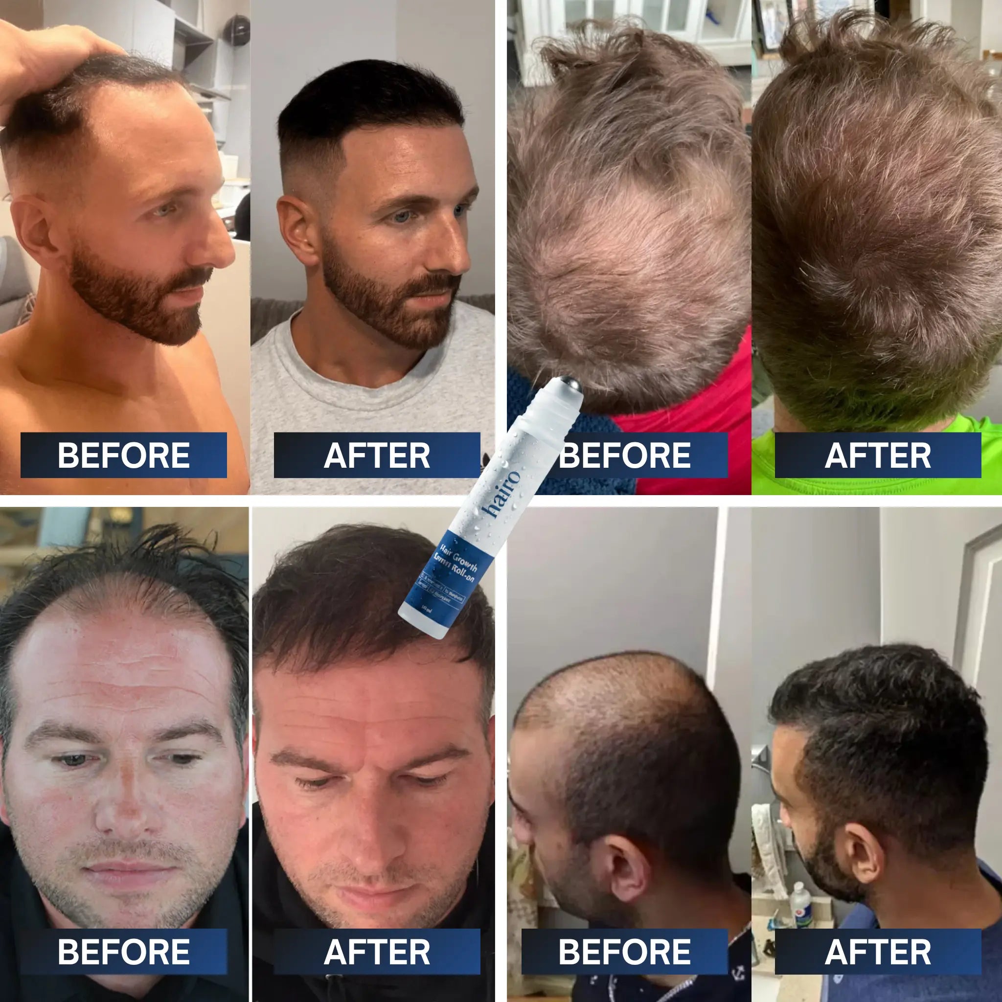 Advanced Hair Growth Roll-On Serum