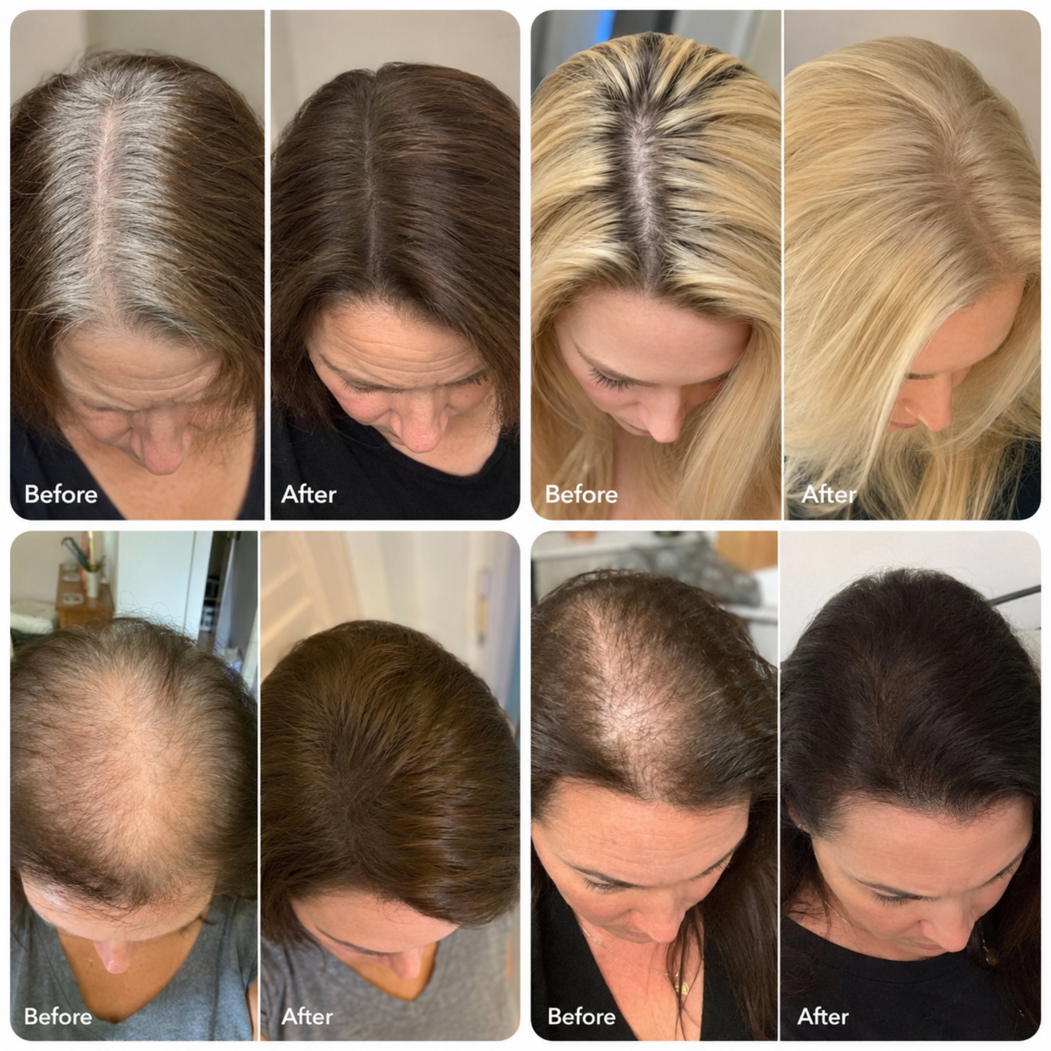 Hair Density Filler For Her