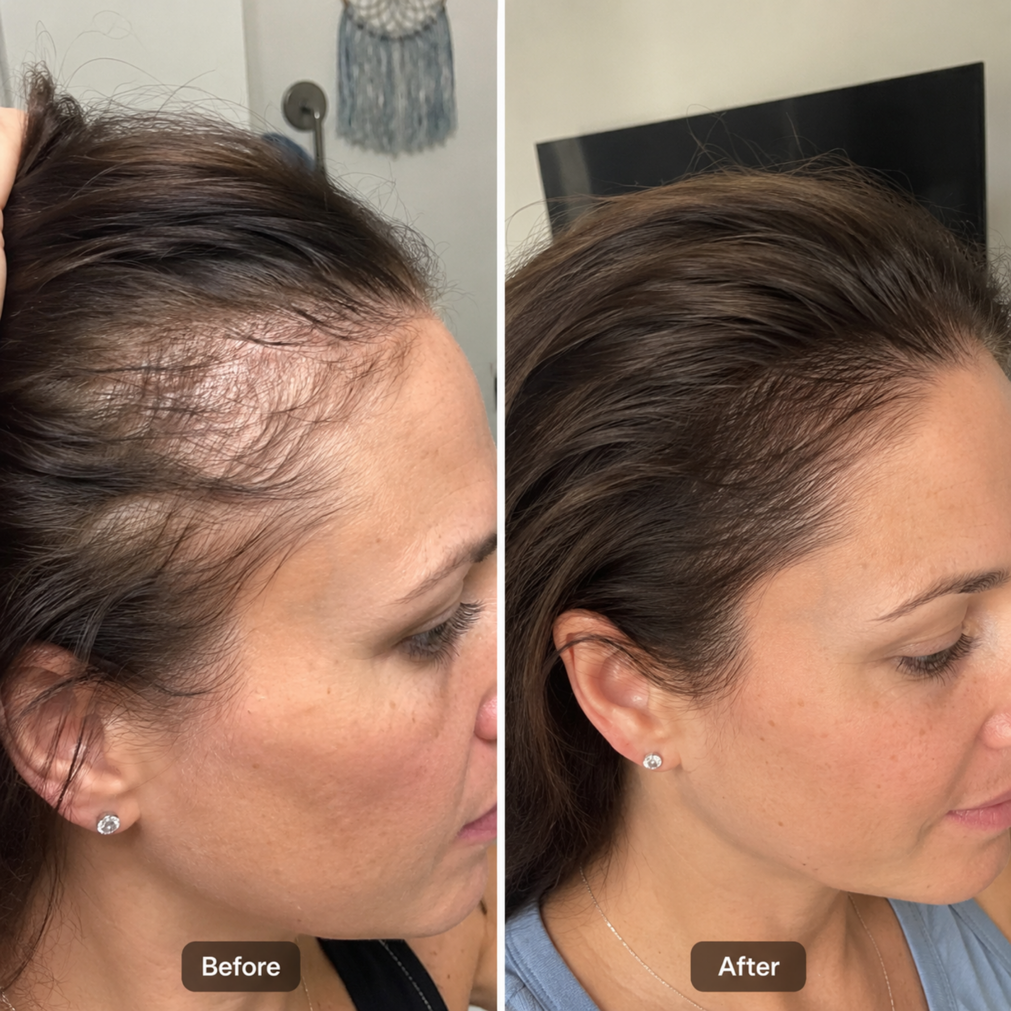 Hair Density Filler For Her