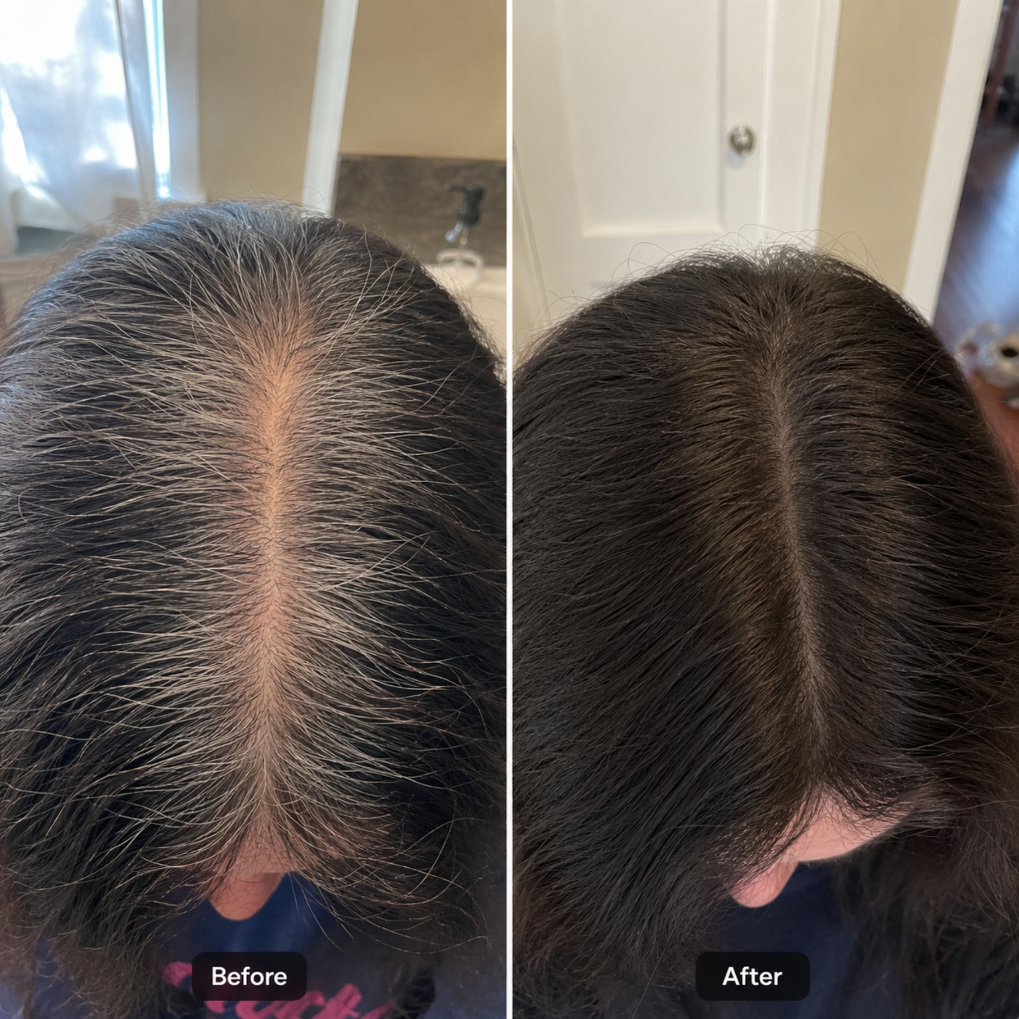 Hair Density Filler For Her